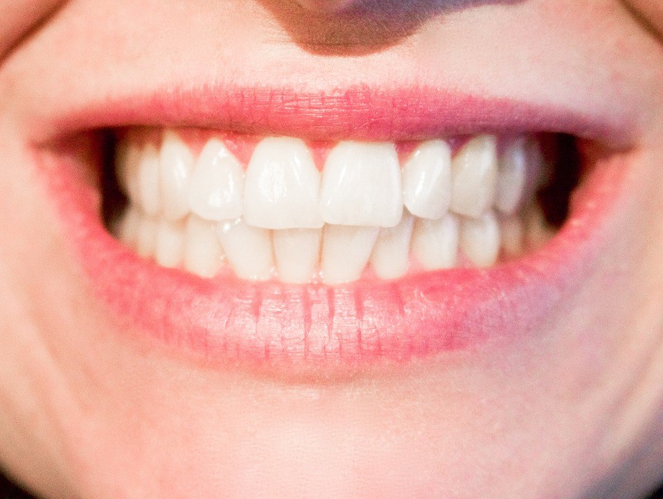 Teeth Whitening Sydney